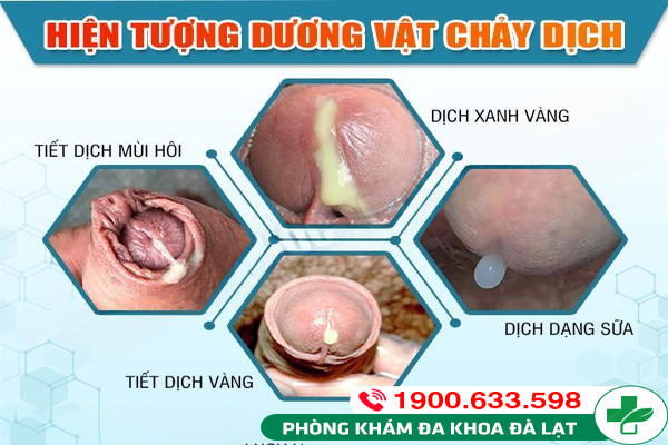 Hình ảnh minh họa